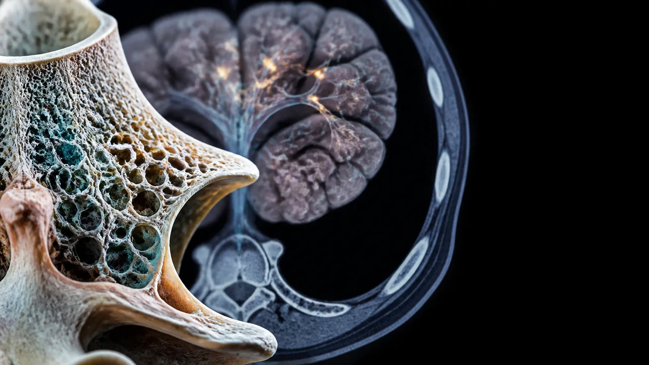 What Spinal Bone Density Can Say About Brain Aging